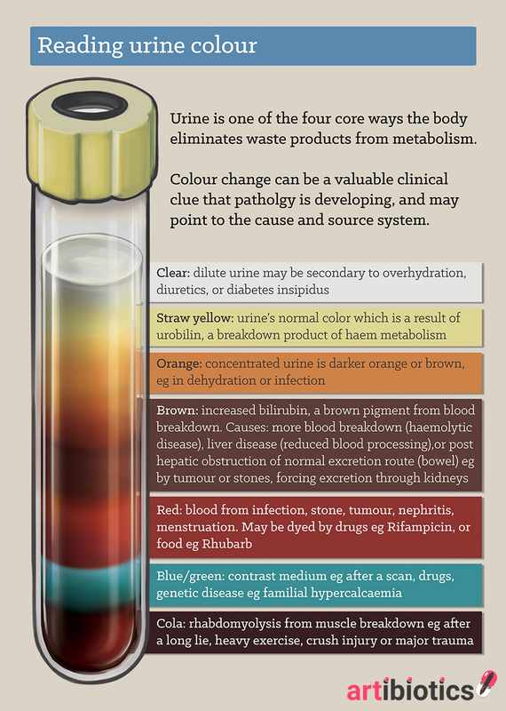 Bilirubin Urine 1_