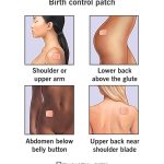 Birth_control_patch_review