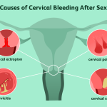 Causes_of_vaginal_bleeding_after_sex
