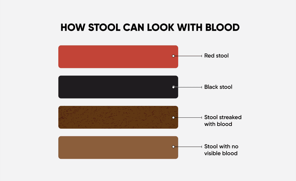 Signs of a Lot of Blood in My Stool_ What Does It Mean_