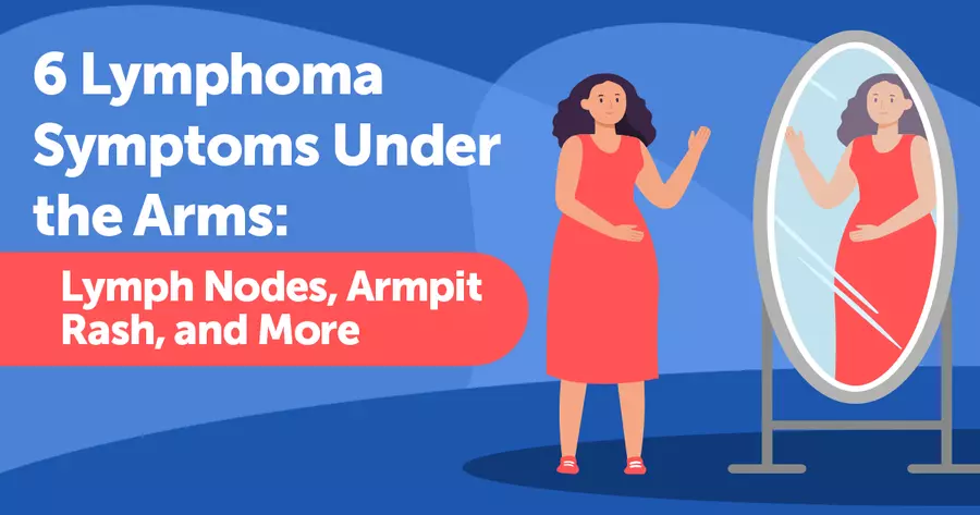 Sore Throat_ Small Raised Bumps Under Armpits with Minor Pain