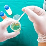 Are_urine_bilirubin_tests_accurate