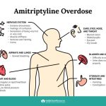 Bladder_side_effects_of_amitriptyline