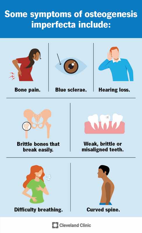 Brittle Bone Disease_ Chromosomes