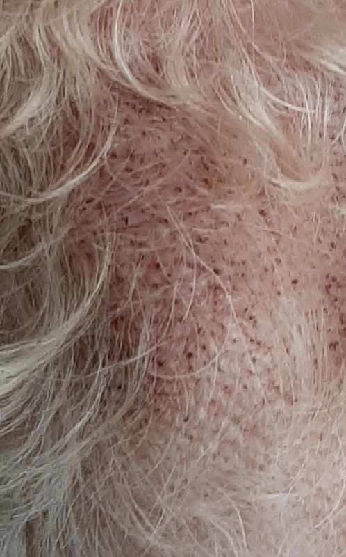 Brown Specks On Dogs Skin