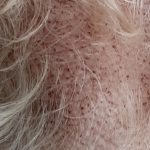 Brown_specks_on_dogs_skin