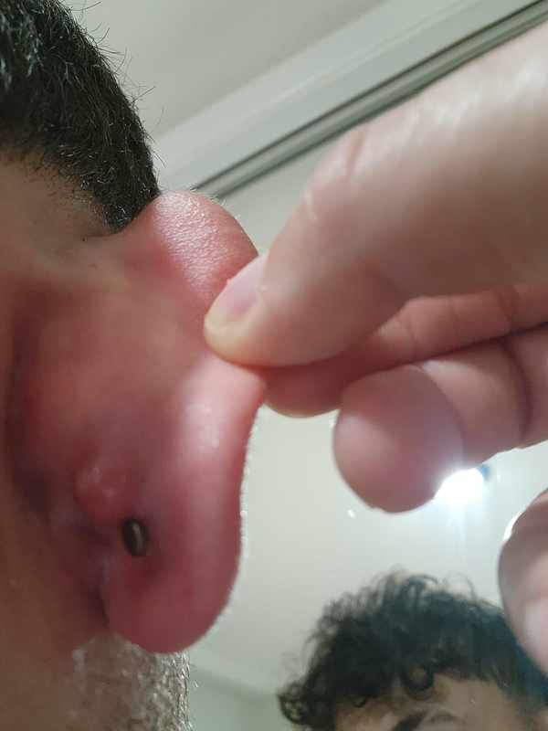 Bump Behind Ear Lobe Piercing