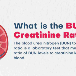 BunCreatinine Ratio High Understanding the Significance_1