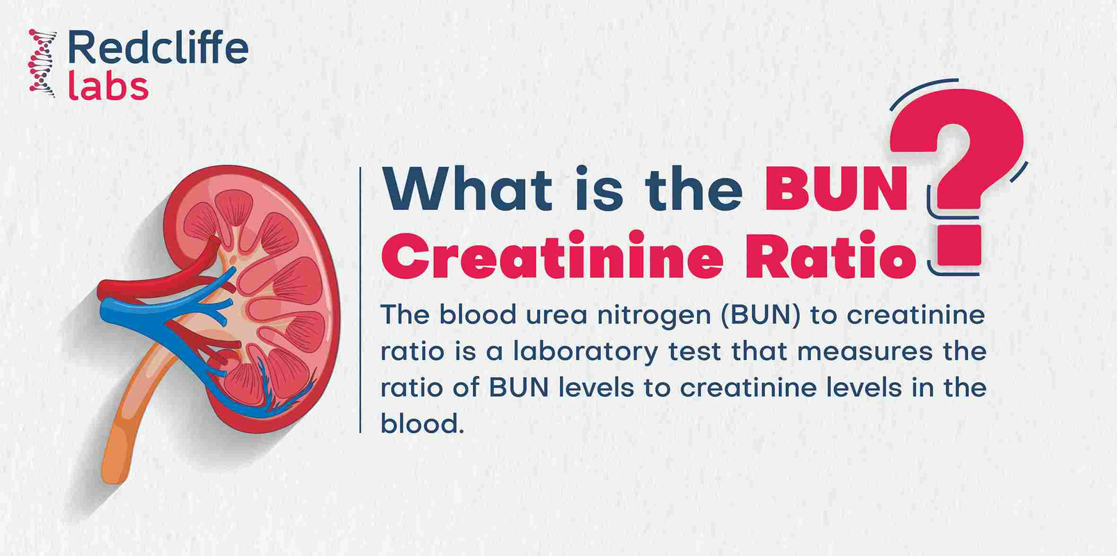Bun_Creatinine Ratio High_ Understanding the Significance