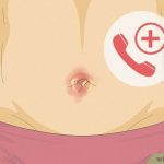 Can You Get a Yeast Infection in Your Belly Button_1