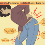 Can_a_knee_problem_cause_back_pain
