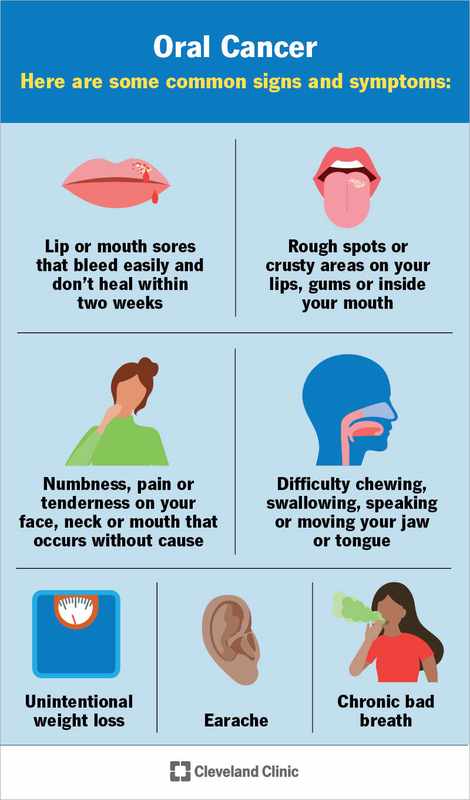 Canker Sore Under Tongue Causing Earache