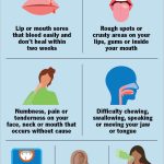 Canker_sore_under_tongue_causing_earache