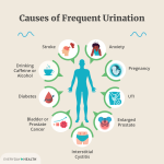 Causes_of_frequent_urination_in_men