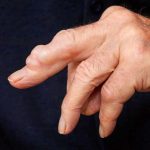 Discovering Bumps on Finger Near Nail Causes Symptoms and Treatment Options_1
