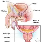 Frequent_urination_and_retention_causes_in_young_men