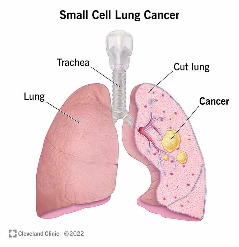 Lung Cancer Symptoms_ Cat Dying from Lung Cancer