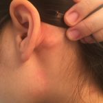 The_bony_bump_behind_ear