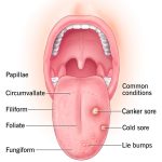 The_painless_bump_under_tongue_understanding_its_causes