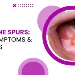 Understanding Bumps in My Mouth Causes Symptoms Treatments_1