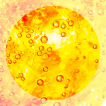Understanding Plus Bilirubin in Urine_1