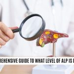 Understanding_alk_phos_high_meaning_a_comprehensive_guide