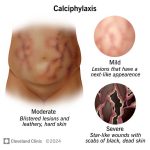 Understanding_brown_scabs_on_dog_causes_and_treatment_options