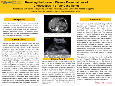 Upper Right Quadrant Pain_ A 40-Year-Old Male Presentation