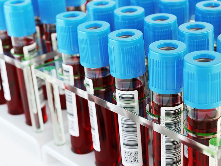 What is an Amylase or Lipase Blood Test_