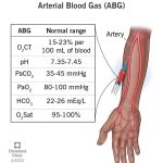 What_is_a_normal_blood_co2_range