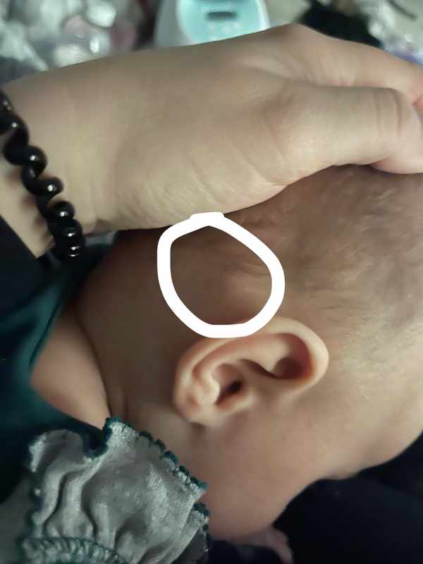 Why Bump Behind Toddler Ear_