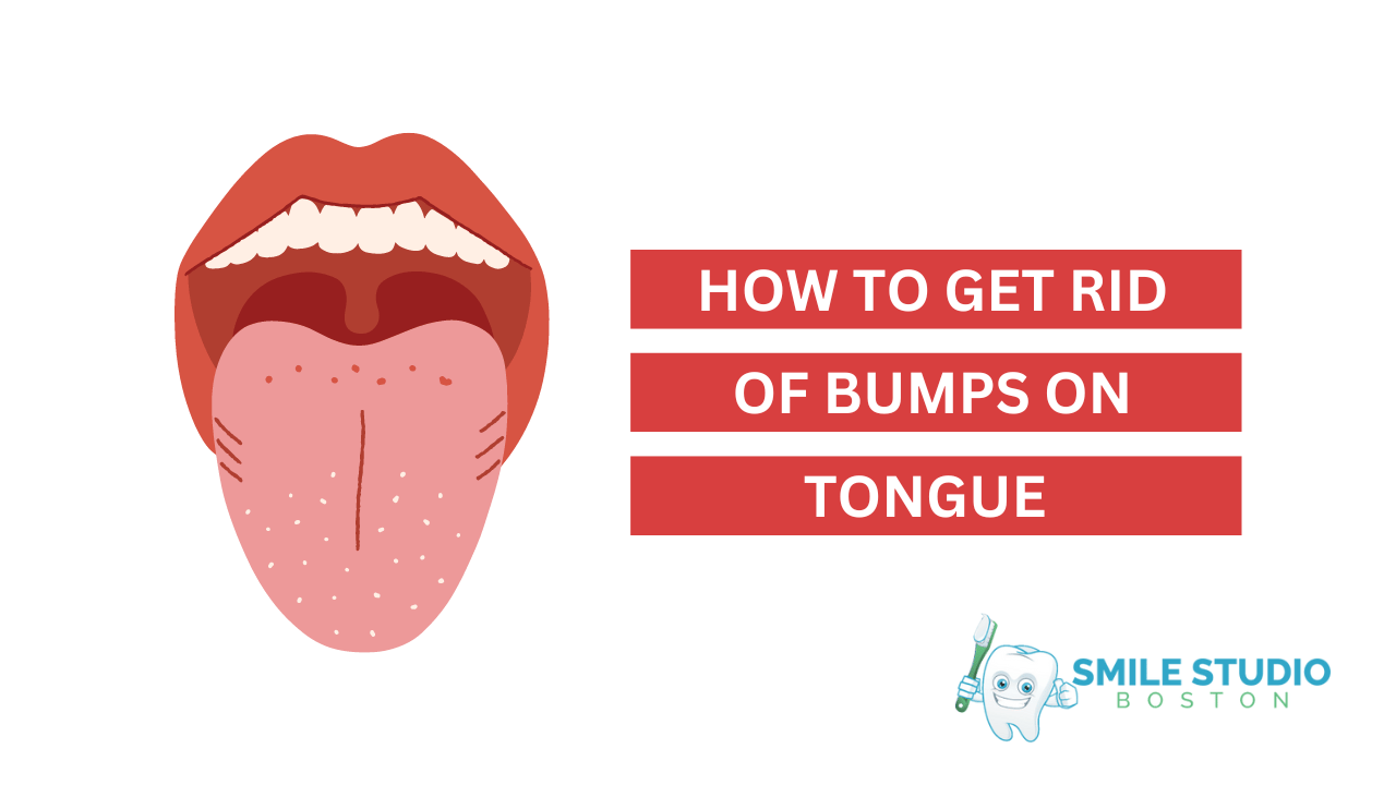 Why You Don_t Feel Pain with Bump Under Tongue