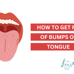 Why_you_don_t_feel_pain_with_bump_under_tongue