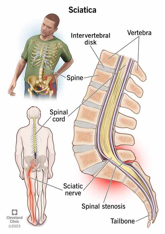 _Will Anti-Seizure Meds Ease Low Back Pain_