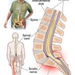 Will_anti-seizure_meds_ease_low_back_pain
