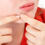 4_year_old_pimples_around_mouth_a_common_concern