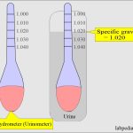 Abnormal_urine_specific_gravity