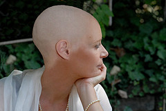 After Chemo_ Bumps on Scalp