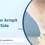 Armpit Pain Lump Expert Guidance for Relief_1