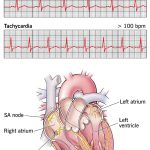 At_rest_the_normal_adult_heart_rate_should_not_exceed