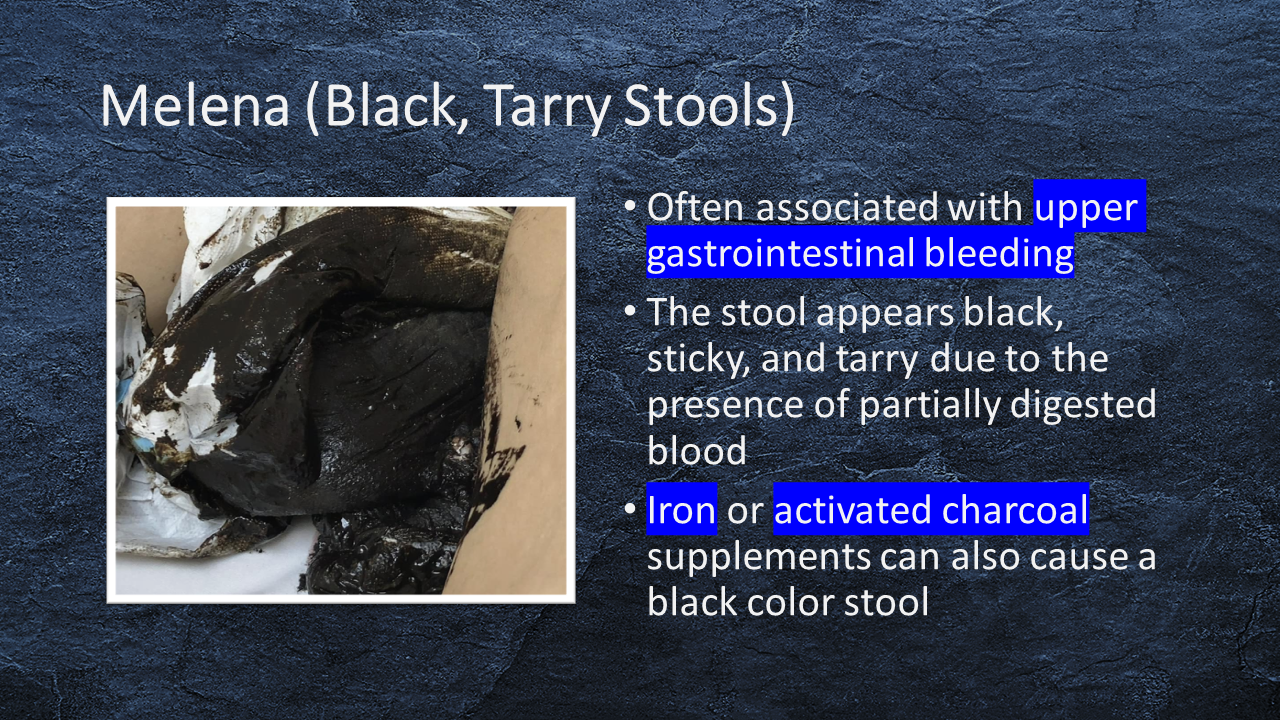 Black Tarry Stool Pictures
