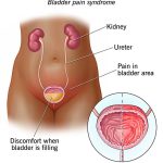 Bladder_side_effects_of_amitriptyline_a_comprehensive_overview