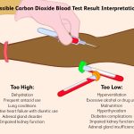 Blood_test_results_low_co2
