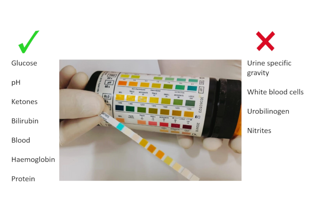 Both Blood and Bilirubin Together in a Urine Dipstick