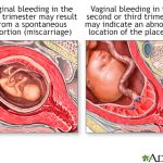 Bright_red_blood_after_sex_during_pregnancy
