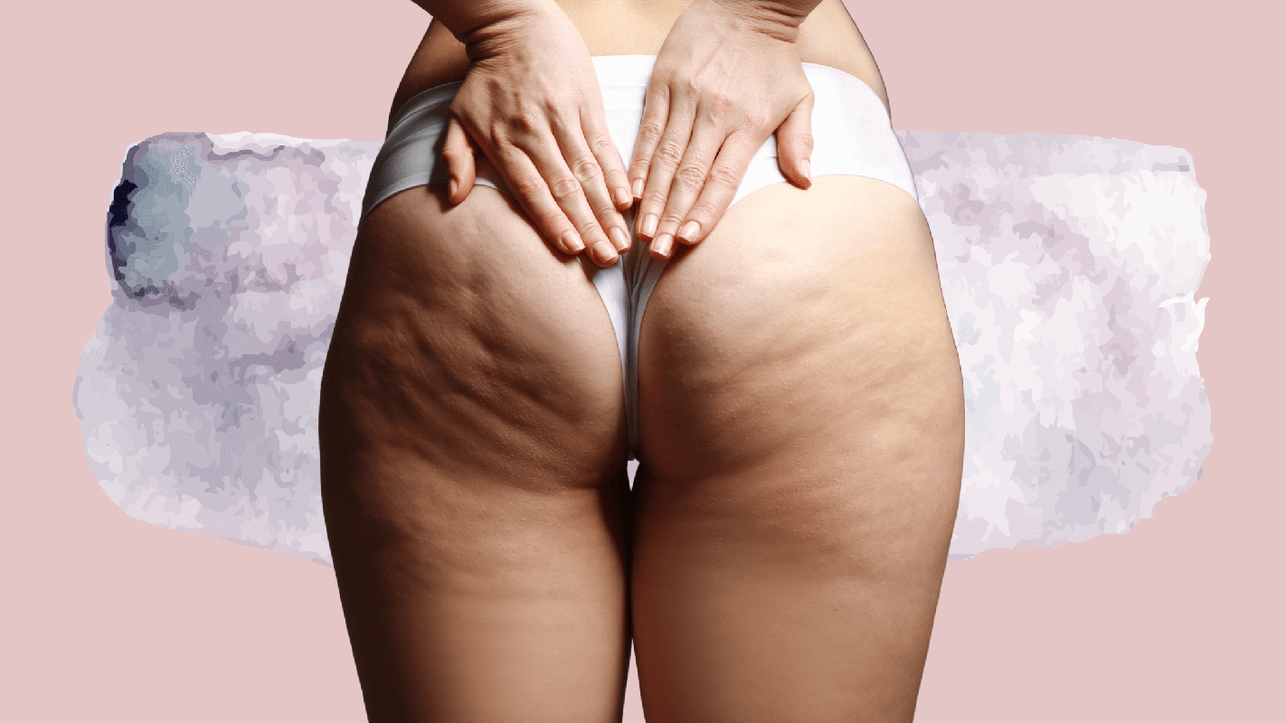 Butt Crack Itchy_ Expert Solutions for Your Uncomfortable Issue