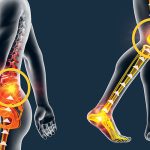 Can_knee_replacement_cause_lower_back_pain