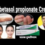 Clobetasol_propionate_cream_used_for