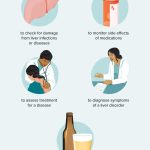 Get_a_blood_test_to_check_liver_function_and_enzymes
