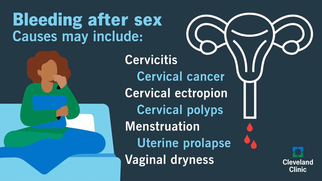 Heavy Bleeding After Sex Just After Period_ Causes_ Symptoms _ Remedies